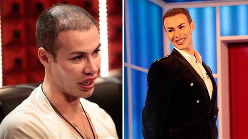 Grande Fratello, il Ken umano senza capelli: l’incredibile trasformazione di Angelo Sanzio