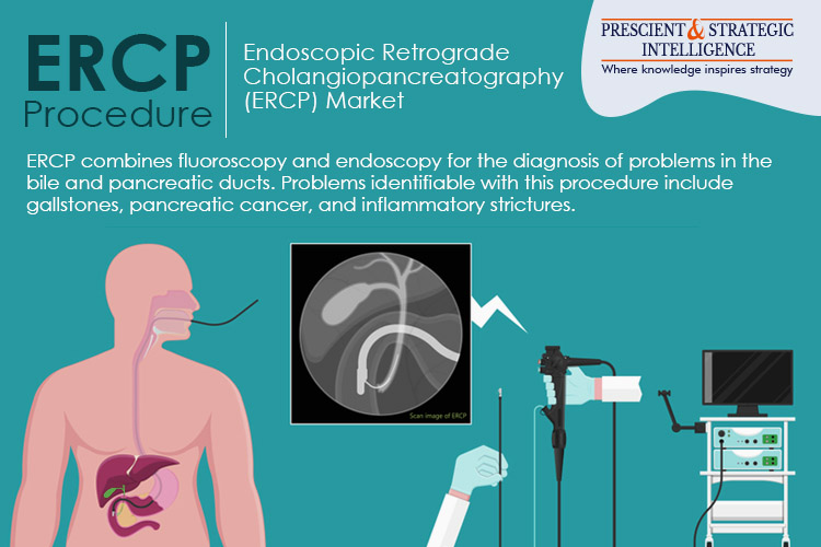 Endoscopic Retrograde Cholangiopancreatography