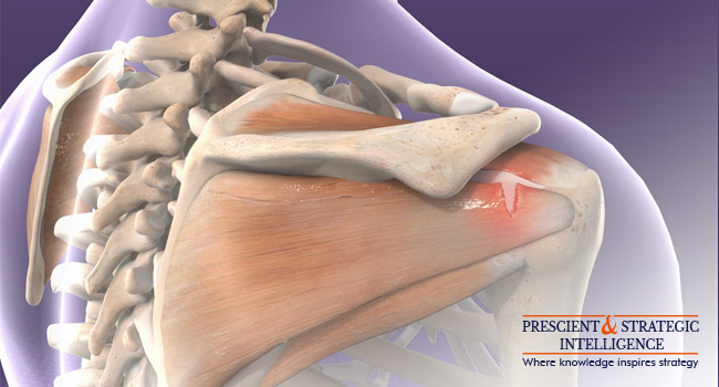 Rotator Cuff Injury Treatment Market