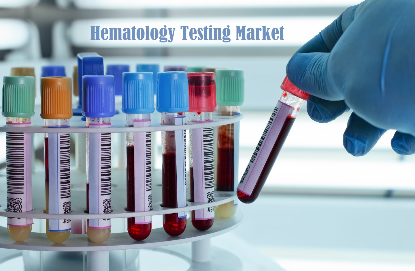 Hematology Testing Industry